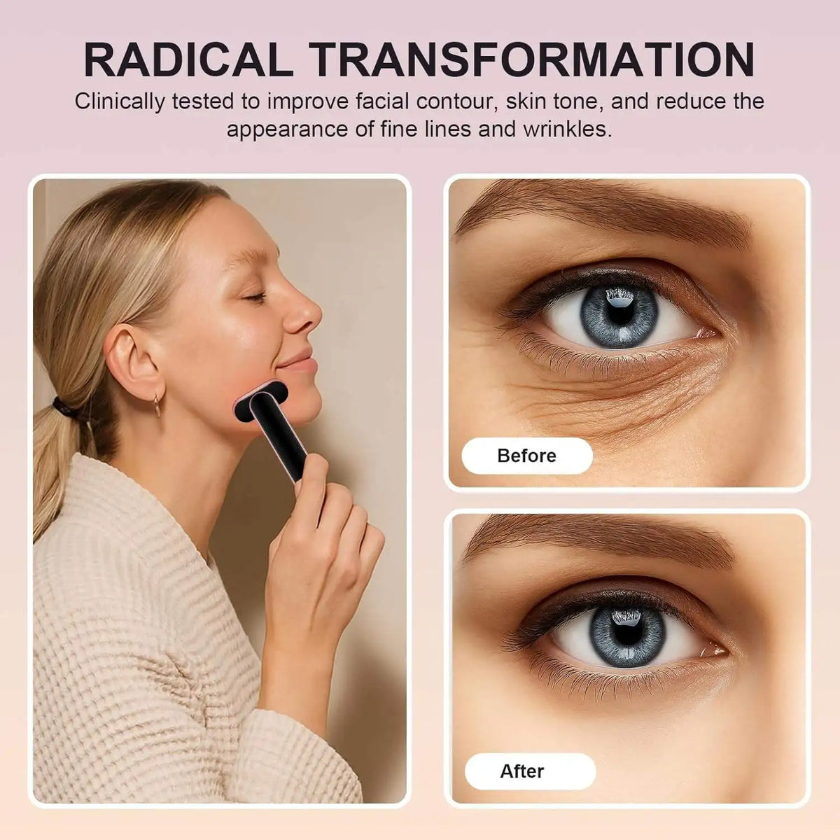 Orevi RF & LED Facial Sculpting Wand